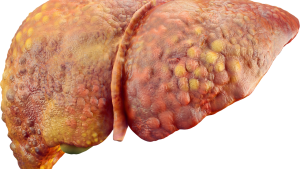 Vitamin D vs Vitamin D3: Are they the same, and which one to consume